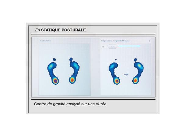 SIDAS PRESSMAT™ Analysverktyg 