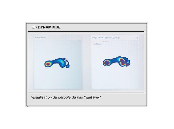 SIDAS PRESSMAT™ Analysverktyg 